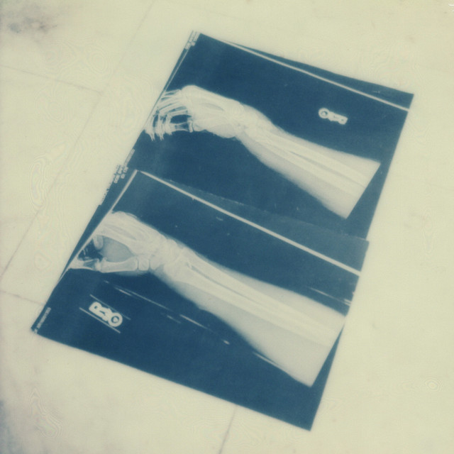 Album artwork for Benoît Pioulard - Radial
